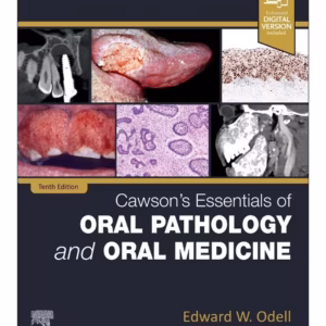 Cawson's Essentials of Oral Pathology and Oral Medicine