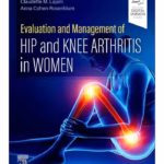 Evaluation and Management of Hip and Knee Arthritis in Women -1st Edition