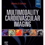 Multimodality Cardiovascular Imaging - 1st Edition