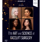The Art and Science of Facelift Surgery - 2nd Edition