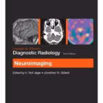 Grainger & Allison’s Diagnostic Radiology: Neuroimaging