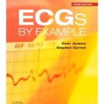 ECGs by Example-3rd EditionD