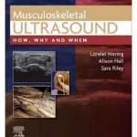 Musculoskeletal Ultrasound-1st Edition