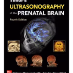 Ultrasonography of the Prenatal Brain -4th Edition