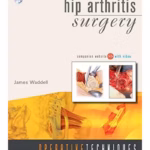 Operative Techniques- Hip Arthritis Surgery- Book, Website& DVD-1st Edition