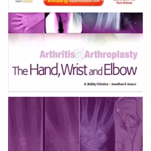 Arthritis& Arthroplasty- The Hand, Wrist& Elbow-1st Edition