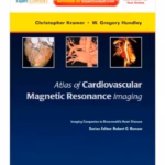Atlas Cardiovascular MR