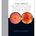 Stereoscopic Atlas/Macular Dis 5/e (2vol)