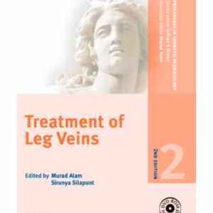 PCDS: Treat of Leg Veins 2/e