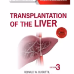 Transplantation of the Liver-3rd Edition