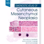 Diagnostic Atlas of Cutaneous Mesenchymal Neoplasia -1st Edition