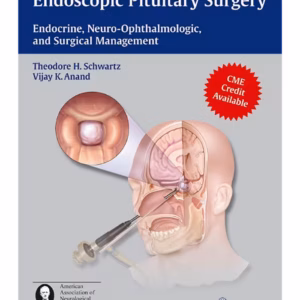 Endoscopic Pituitary Surgery