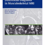 Differential Diagnosis in Musculoskeletal MRI