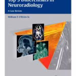 Top 3 Differentials in Neuroradiology 1st Ed.