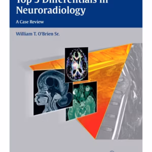 Top 3 Differentials in Neuroradiology 1st Ed.