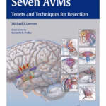 Seven AVMs