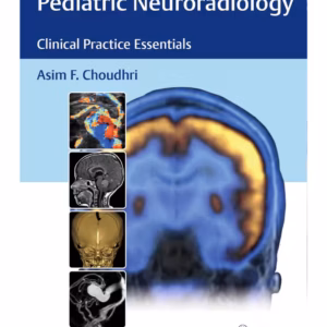 Pediatric Neuroradiology The Essentials 1st Edition