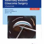 Minimally Invasive Glaucoma Surgery A Practical Guide 1st Edition