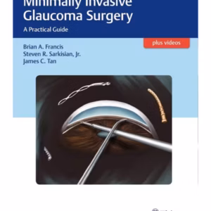 Minimally Invasive Glaucoma Surgery A Practical Guide 1st Edition