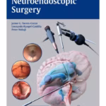 Neuroendoscopic Surgery 1st Edition