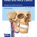 Head and Neck Cancer 2nd Ed.