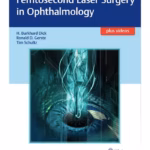Femtosecond Laser Surgery in Ophthalmology 1st Ed.