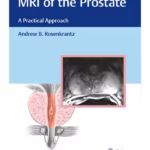 MRI of the Prostate A Practical Approach 1st Edition