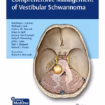 Comprehensive Management of Vestibular Schwannoma 1st Ed.