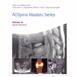 AOSpine Masters Series Volume 10: Spinal Infections 1st Edition