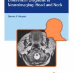 Differential Diagnosis in Neuroimaging Head and Neck 1st Edition