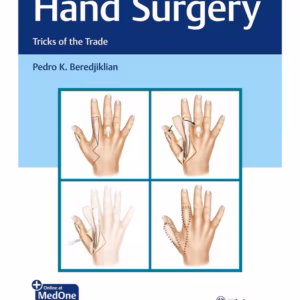 Hand Surgery : Tricks of the Trade 1st Ed.