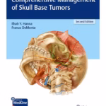 Comprehensive Management of Skull Base Tumors 2nd Ed.
