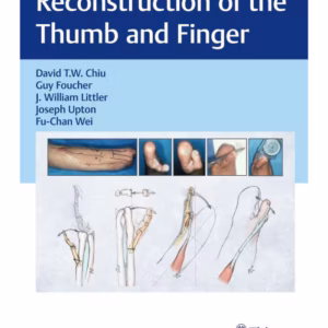 Reconstruction of the Thumb and Finger 1st Edition