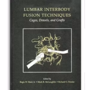 Lumbar Interbody Fusion Techniques: Cages, Dowels, and Grafts 1st Edition