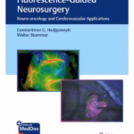 Flurescence - Guided Neurosurgery 1st Ed.