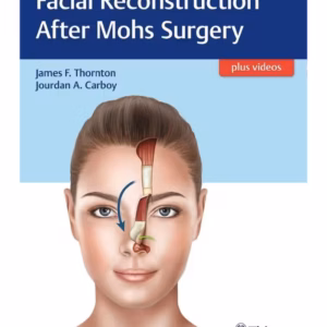 Facial Reconstruction After Mohs Surgery 1st Ed.