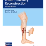Lower Extremity Reconstruction - A Practical Guide1st Ed.