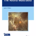 The Retina Illustrated 1st Ed.