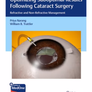 Optimizing Suboptimal Results Following Cataract Surgery 1st Ed.