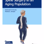 Spine Surgery in an Aging Population 1st Ed.