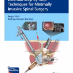 Essential Step-by-Step Techniques for Minimally Invasive Spinal Surgery - 1st Edition