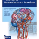 Video Atlas of Neuroendovascular Procedures 1st Edition