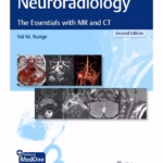 Neuroradiology : The Essentials with MR and CT 2nd Ed.