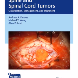 Spine and Spinal Cord Tumors : Classification, Management, and Treatment 1st Ed.