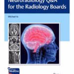 Neuroradiology Q&A for the Radiology Boards 1st Ed.