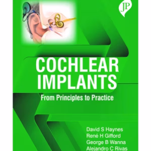 Cochlear Implants: From Principles To Practice