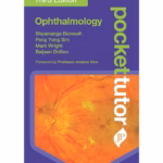 Pocket Tutor Ophthalmology
