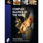 Complex Injuries Of The Hand