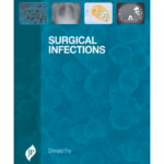 Surgical Infections