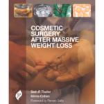 Cosmetic Surgery After Massive Weight Loss